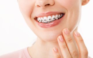 Ortodonție cu aparat dentar: zâmbet frumos și sănătos